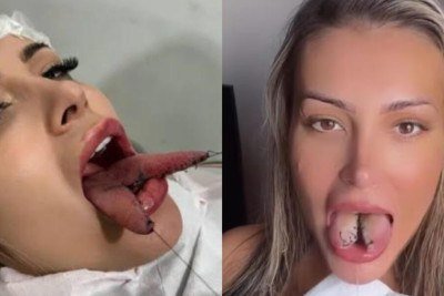 Bifurcação na língua: riscos e alertas de Andressa Urach após arrependimento -  (crédito: Tupi)