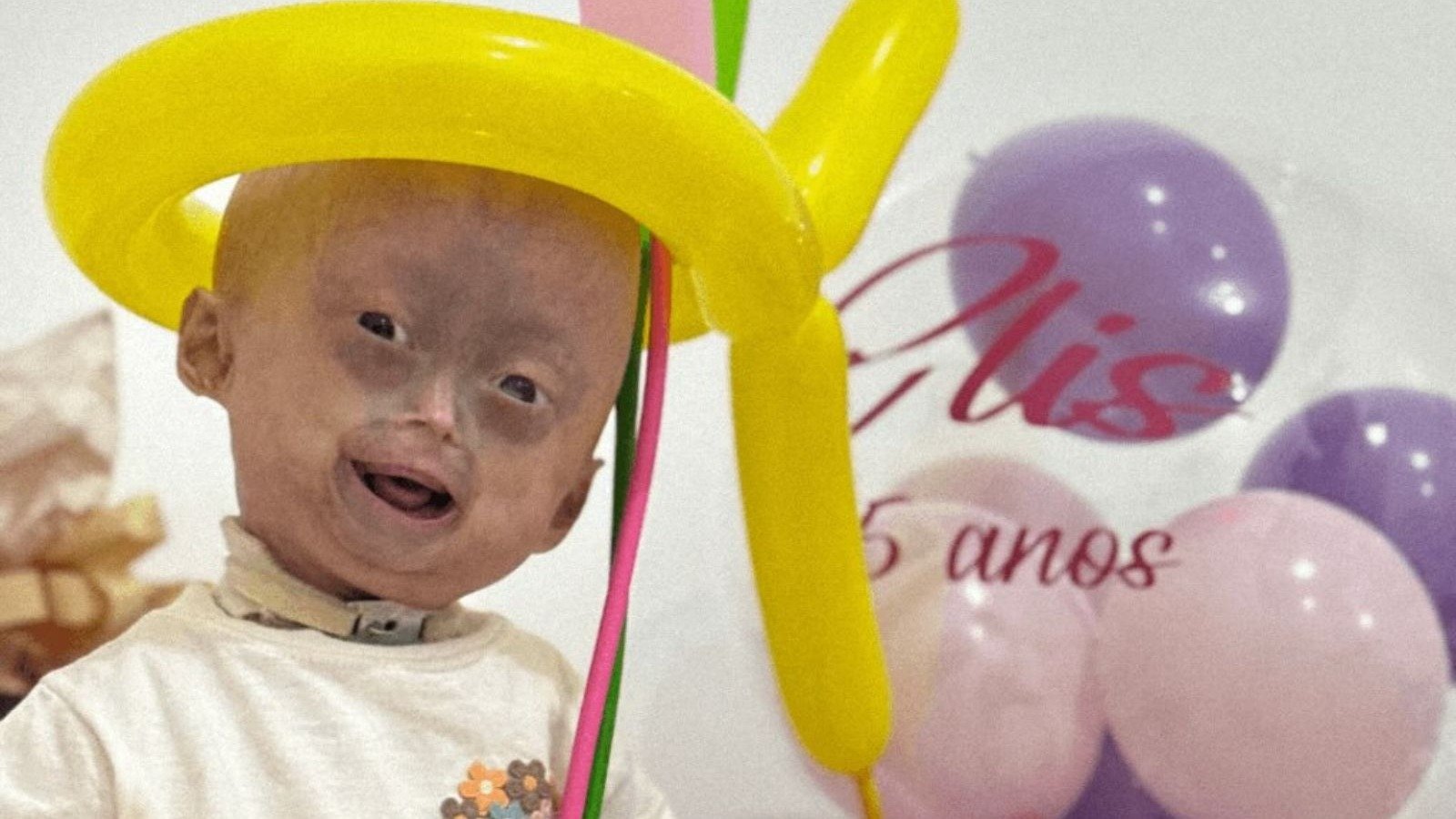 Elis Lima Carneiro, a menina que faleceu aos 5 anos em decorr&ecirc;ncia da prog&eacute;ria, em registro de seu anivers&aacute;rio. -  (crédito: Redes sociais)