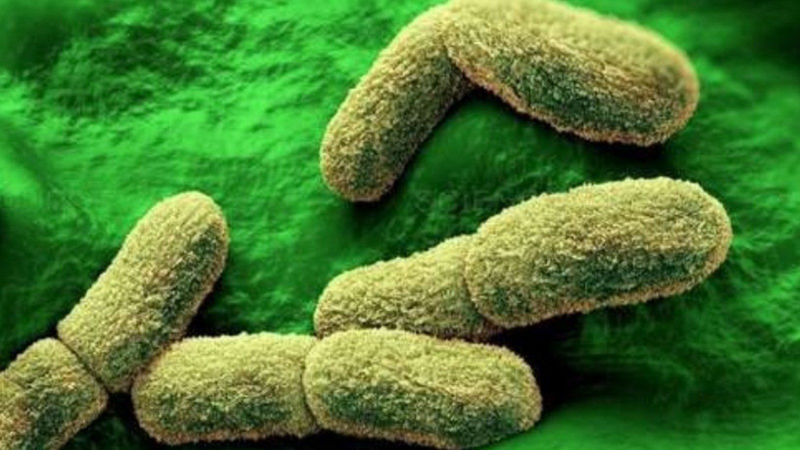 Alerta de peste pulmonar na Rússia chama atenção após morte em laboratório