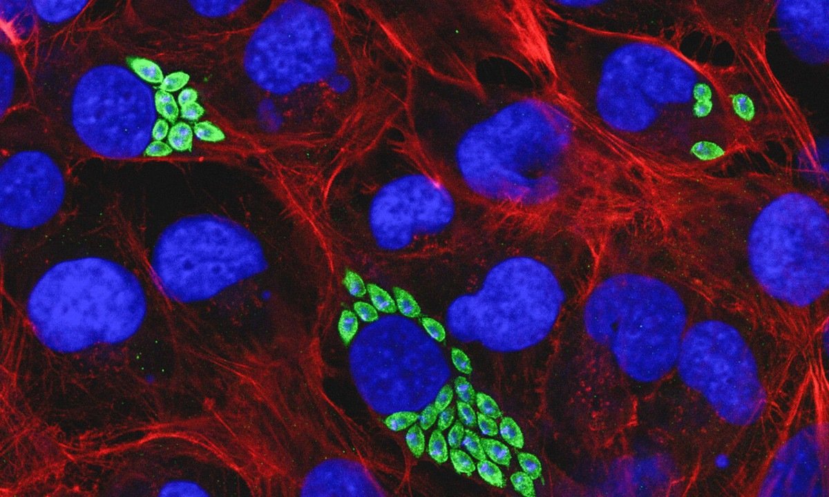 Células do coração infectadas por T. cruzi. Em azul, núcleo; em vermelho, o citoesqueleto; em verde, os parasitas - (crédito: Thaise Lara Teixeira/IQ-USP/Fapesp)