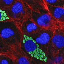 Proteína pouco conhecida é potencial alvo contra a doença de Chagas - Thaise Lara Teixeira/IQ-USP/Fapesp