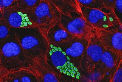 Células do coração infectadas por T. cruzi. Em azul, núcleo; em vermelho, o citoesqueleto; em verde, os parasitas -  (crédito: Thaise Lara Teixeira/IQ-USP/Fapesp)