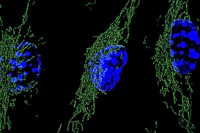 Imagem de microscopia de fluorescência mostra macrófago inflamatório (núcleos celulares em azul) e mitocondrias (em verde) -  (crédito: Pedro Vieira et al./Fapesp)