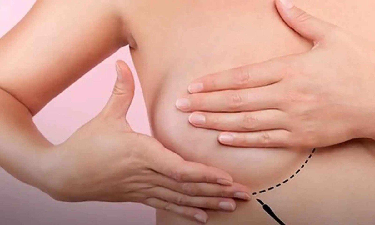 Autoexame é um dos cuidados para a prevenção do câncer de mama -  (crédito: Sociedade Brasileira de Mastologia/divulgação)