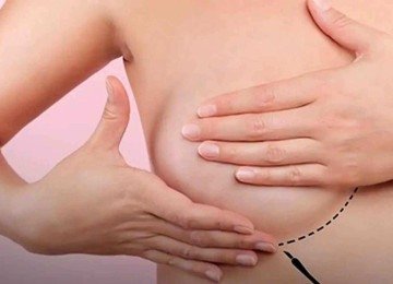 Autoexame é um dos cuidados para a prevenção do câncer de mama -  (crédito: Sociedade Brasileira de Mastologia/divulgação)