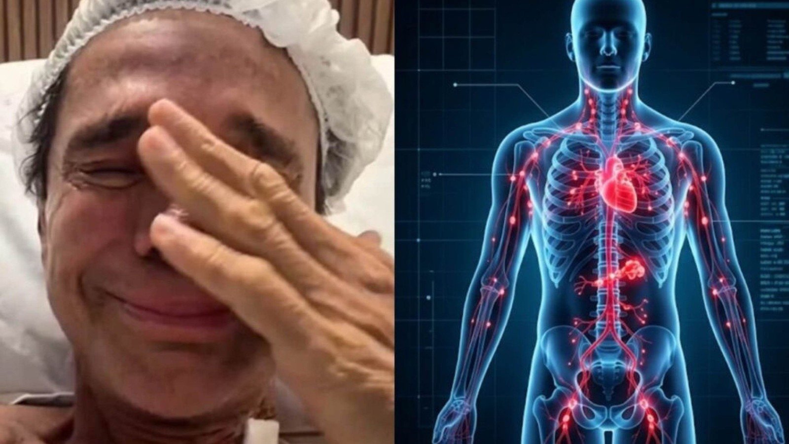 Morte de Netinho abre debate sobre perigos do linfoma não Hodgkin