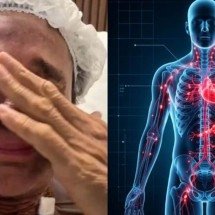 Morte de Netinho abre debate sobre perigos do linfoma não Hodgkin - Tupi