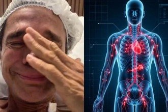 Morte de Netinho abre debate sobre perigos do linfoma não Hodgkin