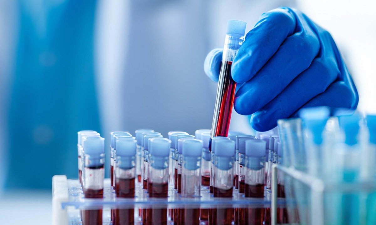 O projeto conta com 4.062 participantes e quase 40 mil amostras derivadas de sangue - (crédito: Shutterstock/Fapesp)