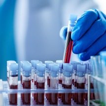 Biorrepositório pode ajudar a personalizar a prevenção do câncer no SUS - Shutterstock/Fapesp