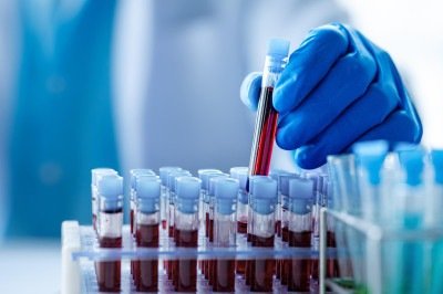 O projeto conta com 4.062 participantes e quase 40 mil amostras derivadas de sangue -  (crédito: Shutterstock/Fapesp)