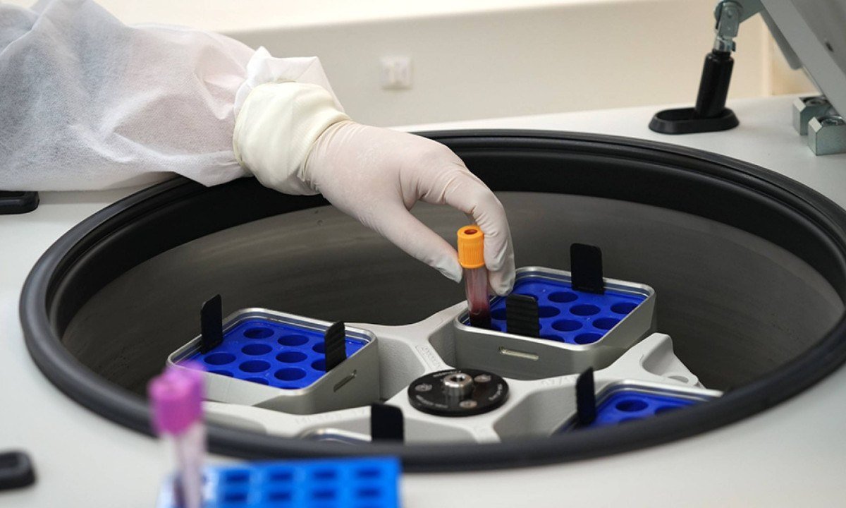 O trabalho analisou 136 pacientes com melanoma e tratados com imunoterapia entre 2016 e 2024 pelo SUS - (crédito: Hospital do Amor/Fapesp/Reprodução)