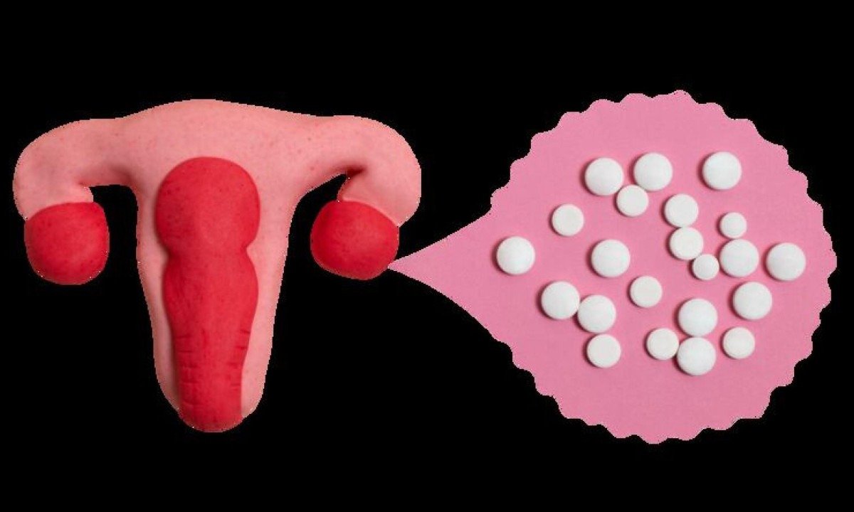 A questão passa a envolver a oportunidade de preservar a fertilidade antes de começar o tratamento - (crédito: magnific)