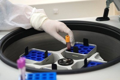O trabalho analisou 136 pacientes com melanoma e tratados com imunoterapia entre 2016 e 2024 pelo SUS -  (crédito: Hospital do Amor/Fapesp/Reprodução)