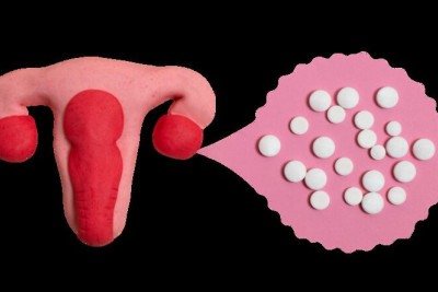 A questão passa a envolver a oportunidade de preservar a fertilidade antes de começar o tratamento -  (crédito: magnific)