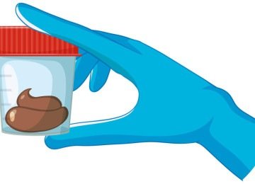 Realizado por meio da coleta de fezes, o FIT é um teste imunológico que detecta a presença de hemoglobina humana -  (crédito: brgfx/magnific)
