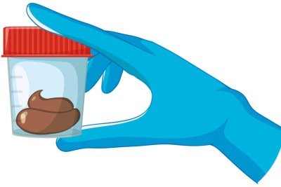 Realizado por meio da coleta de fezes, o FIT é um teste imunológico que detecta a presença de hemoglobina humana -  (crédito: brgfx/magnific)