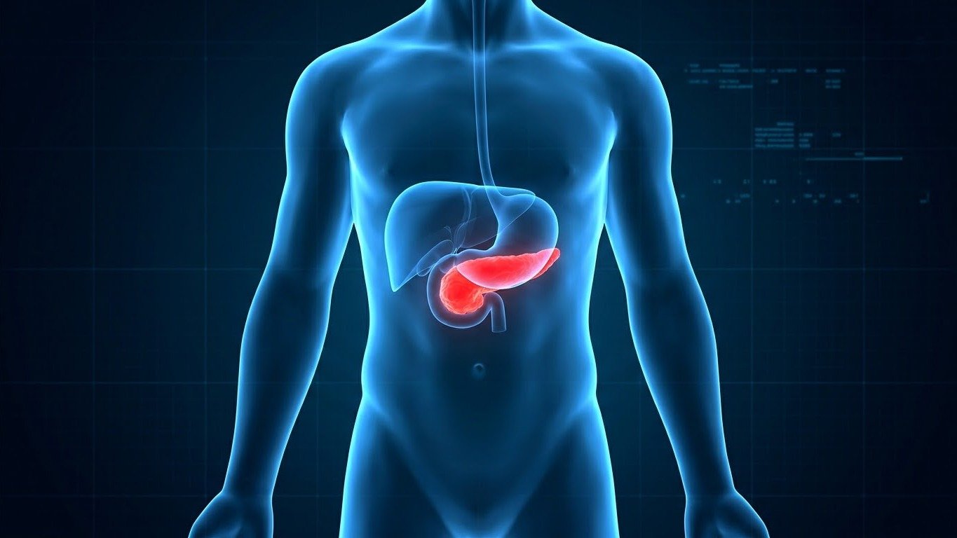 P&acirc;ncreas: &oacute;rg&atilde;o-alvo de um novo f&aacute;rmaco que promete dobrar a sobrevida em casos de c&acirc;ncer metast&aacute;tico -  (crédito: Imagem Ilustrativa de IA)