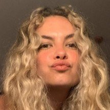 Entenda a luta secreta de Lua Blanco contra o câncer de intestino - Instagram/Reprodução