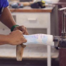 Campanha em BH arrecada meias-calças para confeccionar órteses - AMR/Divulgação