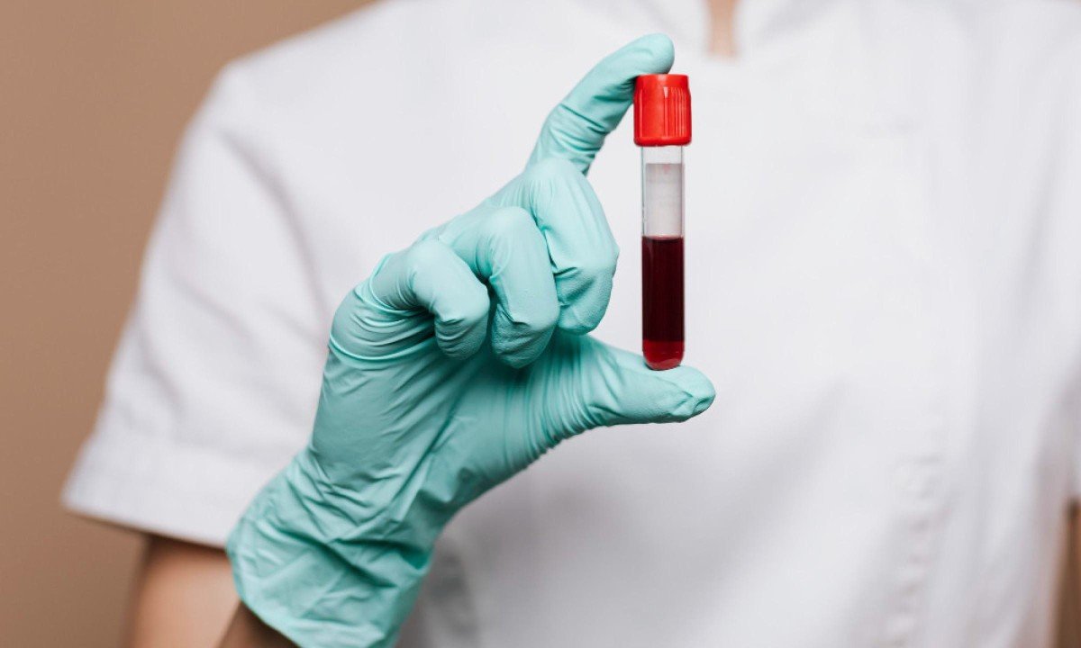 A técnica proteômica é capaz de medir milhares de proteínas simultaneamente em uma única amostra de sangue - (crédito: rawpixel.com/magnific)