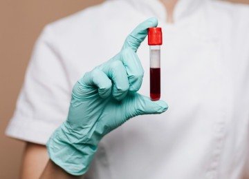 A técnica proteômica é capaz de medir milhares de proteínas simultaneamente em uma única amostra de sangue -  (crédito:  rawpixel.com/magnific)