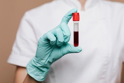 A técnica proteômica é capaz de medir milhares de proteínas simultaneamente em uma única amostra de sangue -  (crédito:  rawpixel.com/magnific)