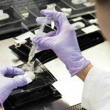 Estudos revelam avanços no tratamento de câncer de pulmão e melanoma - Nasa/Divulgação 