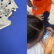 Criança de 2 anos fica com dedo preso em ralo de ferro em Minas  - Reprodução/CBMMG