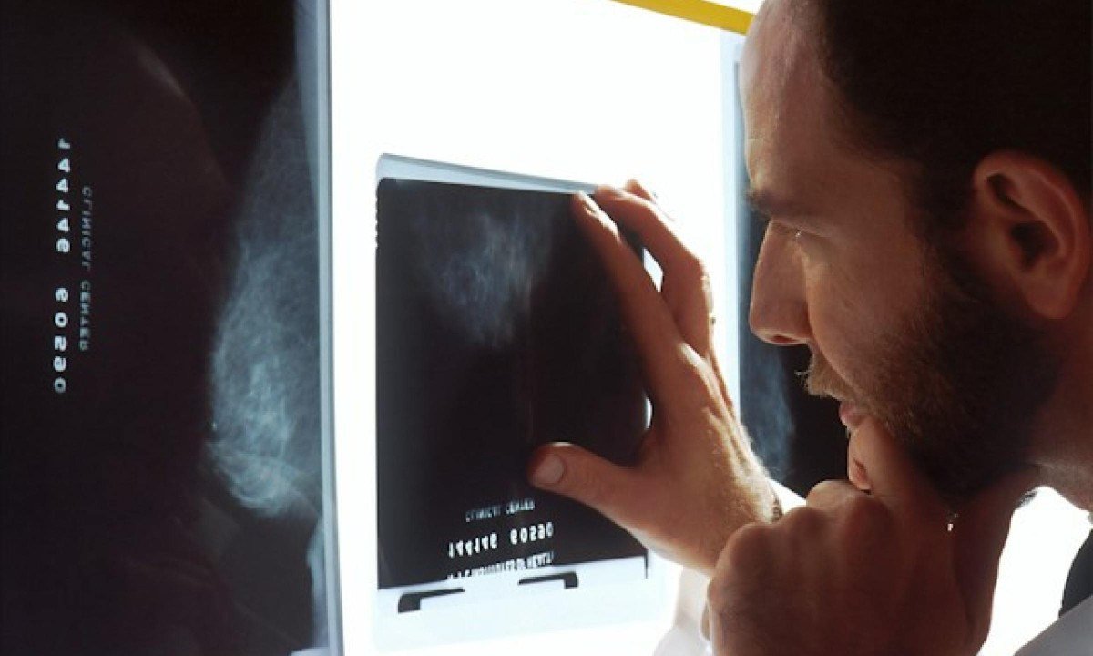 A orientação também se dirige a clínicas, serviços de diagnóstico por imagem e operadoras - (crédito: National Cancer Institute/Unsplash)