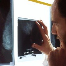 Médicos lançam guia para evitar recusa de mamografia digital -  National Cancer Institute/Unsplash