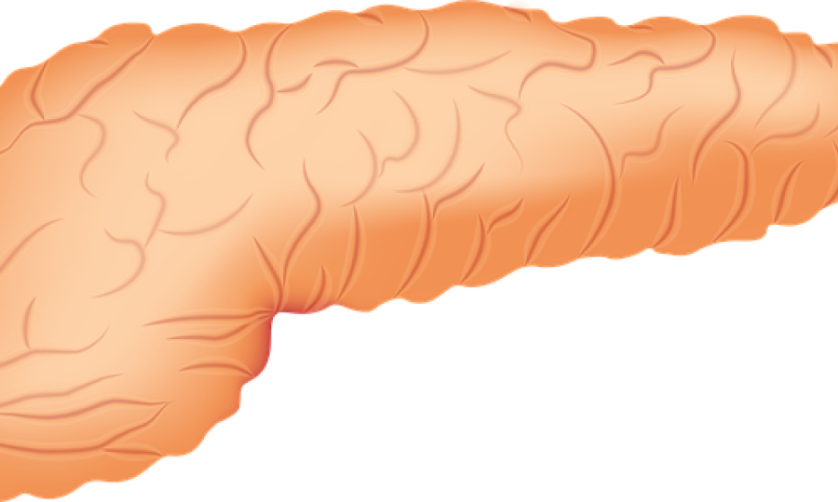 Combinação de radioterapia com medicamentos que agem contra o tumor pancreático apresenta melhor eficácia de ataque ao câncer, além de resposta geral ao tratamento superior, diz estudo -  (crédito: zachvanstone8/Pixabay)