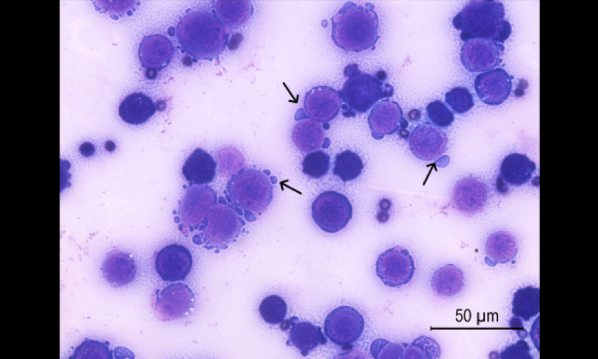 
Células tumorais de camundongos que receberam tratamento com  a dose de 0,9 micrograma de crotoxina ; as setas indicam o processo de morte celular -  (crédito: Camila Lima Neves/Instituto Butantan )