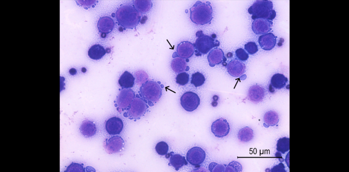 Toxina do veneno da cascavel induz célula de defesa a combater o câncer