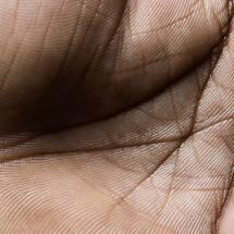 Como os bilhões de micróbios em nossa pele mantêm nossa saúde - Getty Images