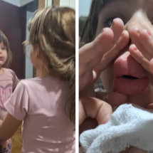 Menina se desespera ao ver lábios inchados após brincadeira com desodorante - Reprodução / Instagram