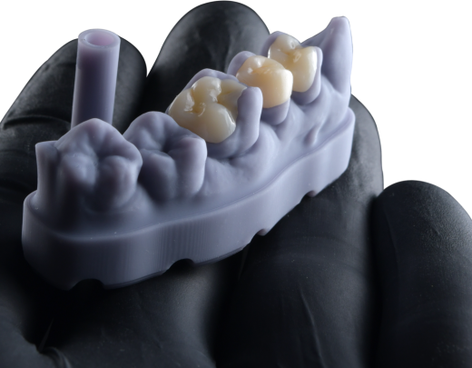 FGM Dental Group e dOne 3D apresentam a Voxelprint Ceramic -  (crédito: DINO)