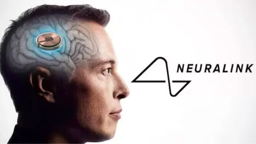 A Neuralink, empresa do bilionário Elon Musk, realizou com sucesso no começo de 2024 o primeiro implante de um chip cerebral em um ser humano. -  (crédito: divulgação)