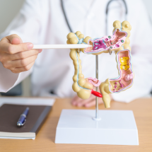 Exame de sangue nas fezes é opção acessível para rastrear câncer colorretal - DINO