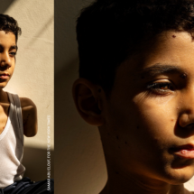 A história da chocante 'foto do ano' de menino palestino mutilado - World Press Photo