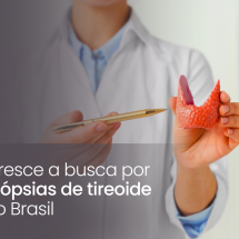 Cresce a busca por biópsias de tireoide no Brasil - DINO