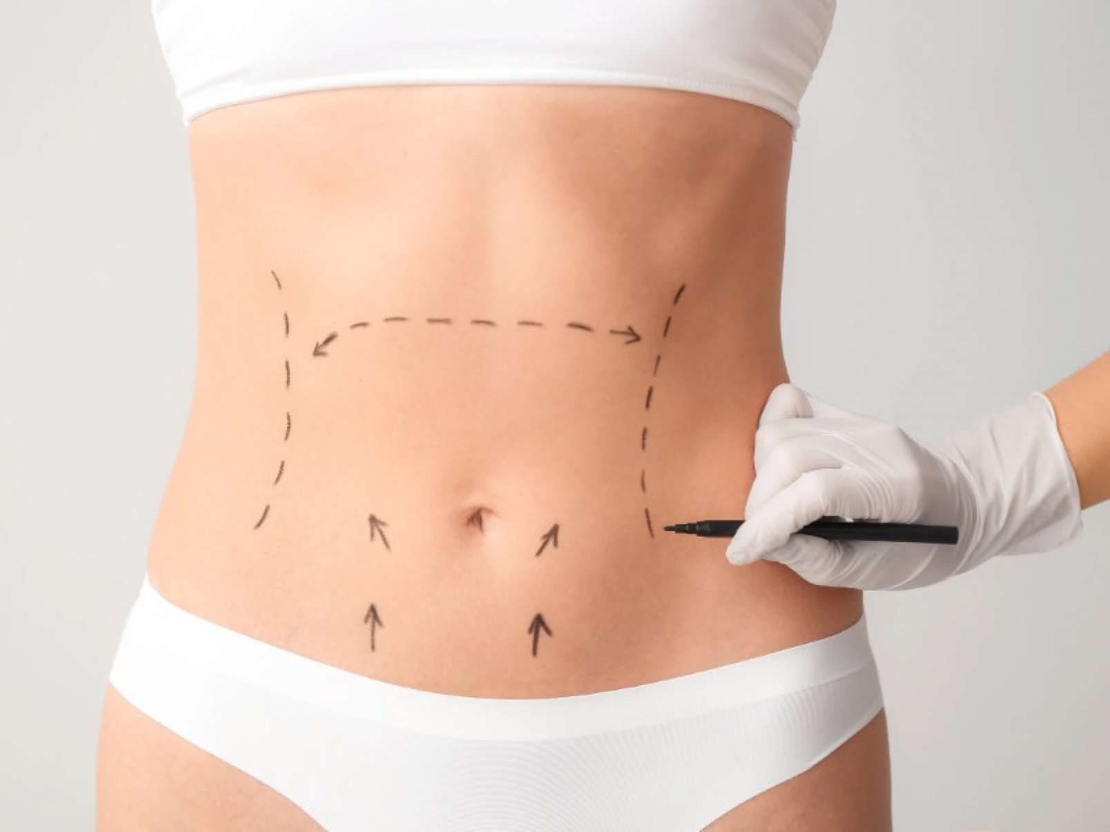 Avanços técnicos ajudam a reduzir cicatrizes cirúrgicas - DINO