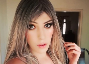 Alice foi espancada em 23 de outubro, ap&oacute;s, supostamente, sair do Bar Rei do Pastel, na Savassi, sem pagar a conta -  (crédito: Redes Sociais )