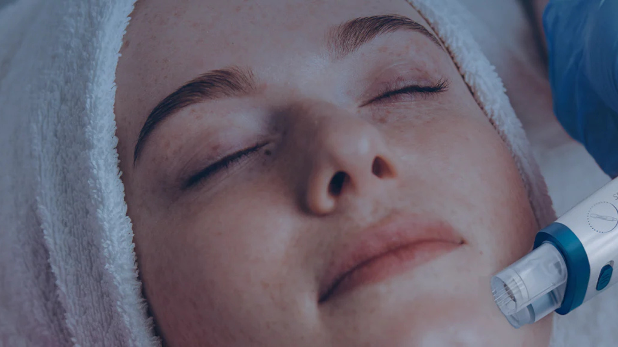 Técnica de microagulhamento ganha novas tecnologias em 2025 - DINO