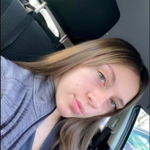 Coisa esquisita: Mulher mordida por cão fica com pelo no nariz - reprodução facebook