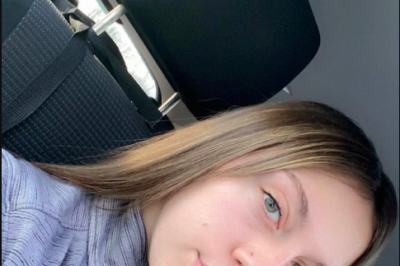 Deu o que falar a história de uma enfermeira de 20 anos que, depois de precisar fazer um enxerto por conta da mordida de um cão, começou a ter pelos no nariz. O FLIPAR mostrou e republica para quem não viu. . -  (crédito: reprodução facebook)