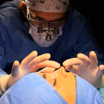Rinoplastia ultrassônica avança em cirurgias nasais - DINO