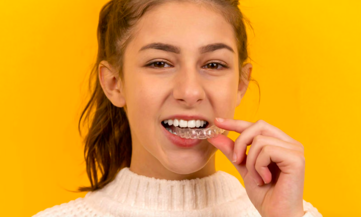 Alinhador invisível: como funciona o tratamento dentário - (crédito: DINO)