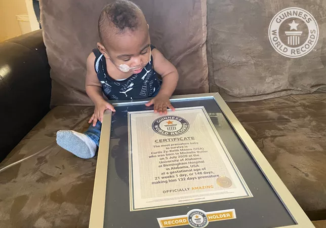 Bebê mais prematuro do mundo comemora aniversário - Guinness World Records