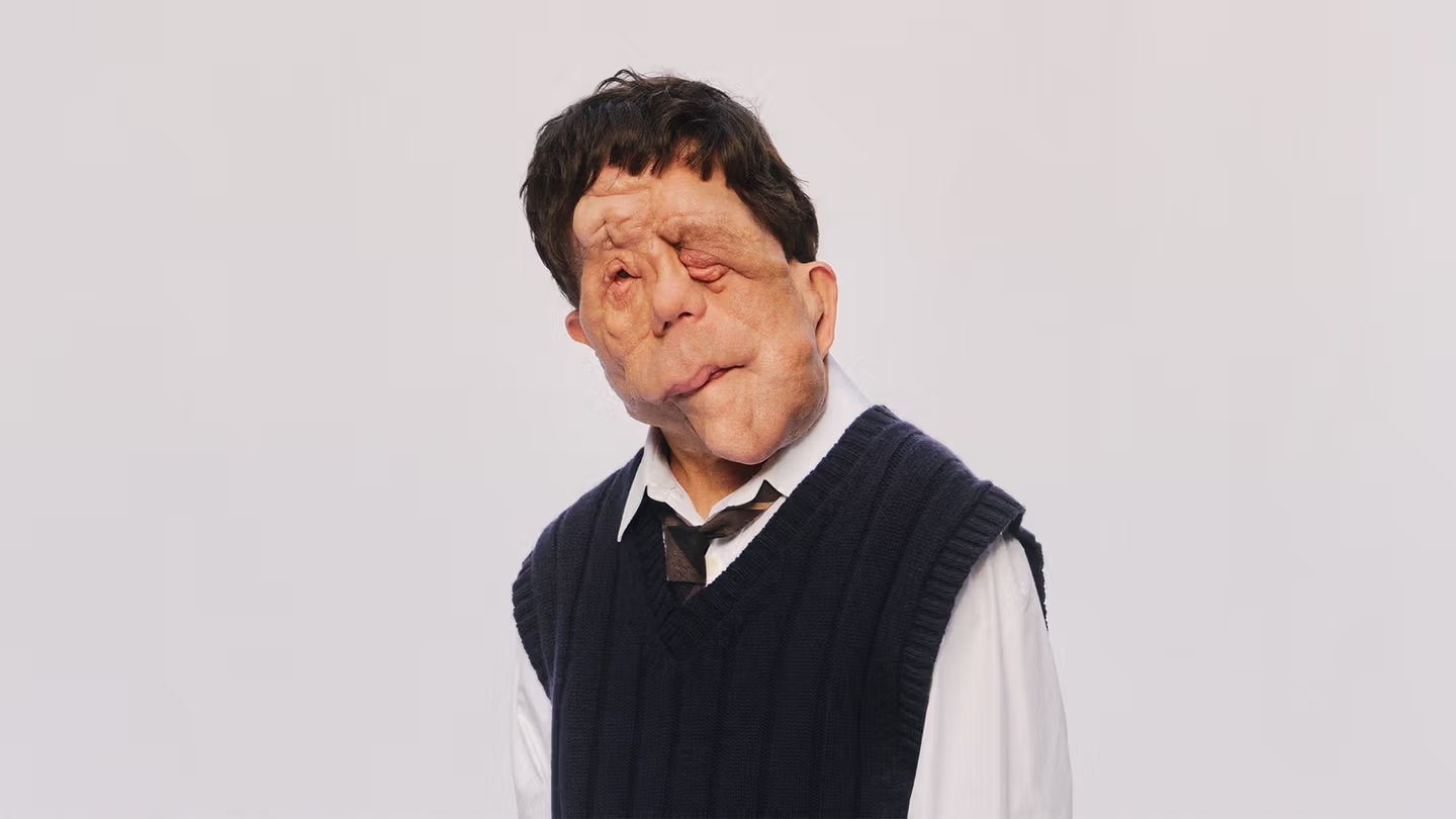 Adam Pearson atuou nos filmes "Sob a pele" (2013) e "Um homem diferente" (2024), indicado ao Oscar de Melhor Maquiagem e Penteado. -  (crédito: Will Corry/Reprodução)